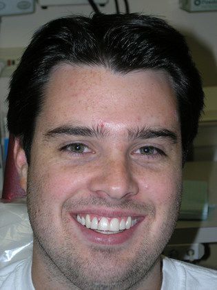 A close up of a man 's face with a smile on his face.