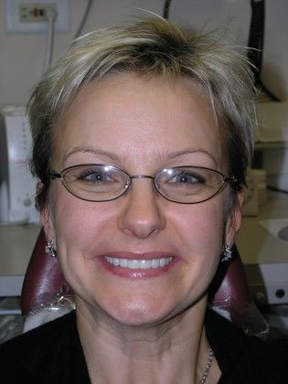 A woman wearing glasses and earrings is smiling in a dental chair.