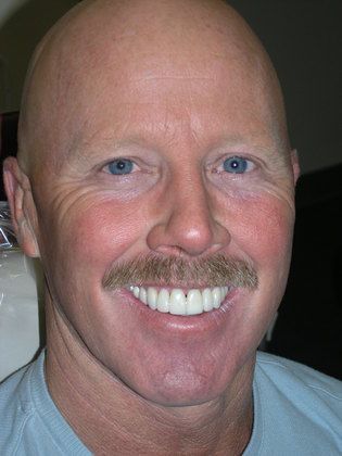 A bald man with a mustache is smiling for the camera.