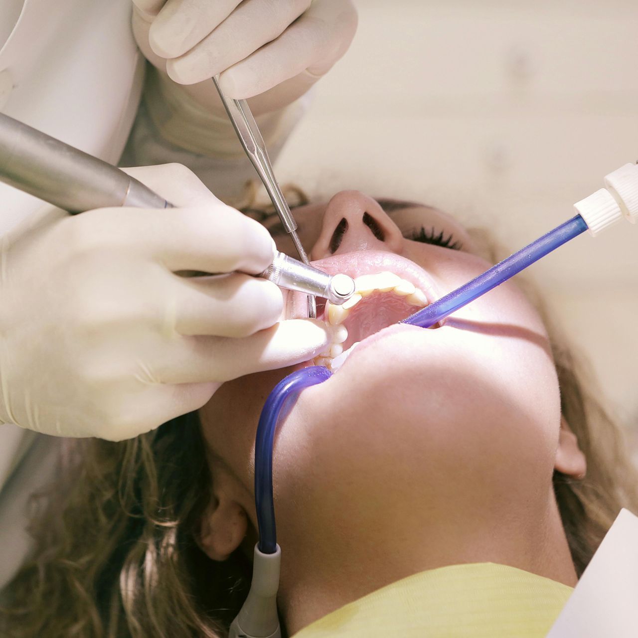 Una mujer se hace examinar los dientes por un dentista.