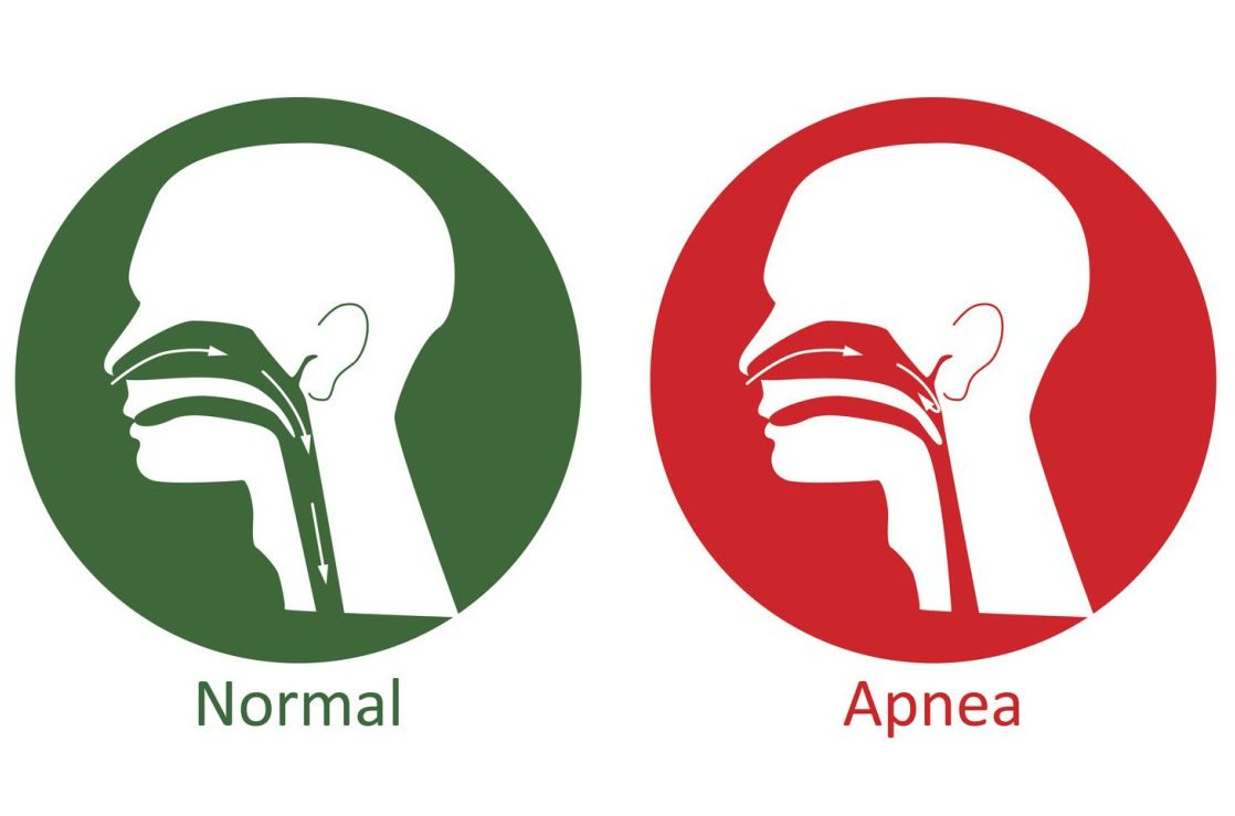 Man smiling while in dentist's chair — Alexander City, AL — Harrell Orthodontic Services