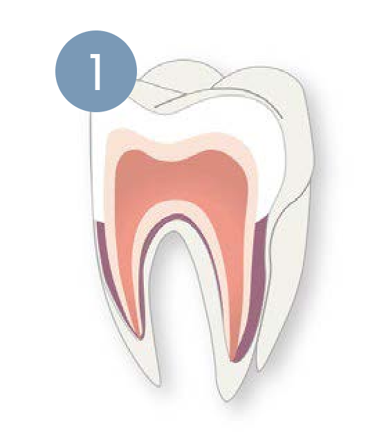 A diagram of a tooth with a number 1 on it.