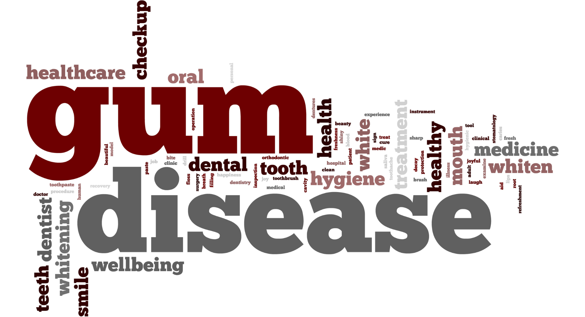 Gum Disease in San Diego