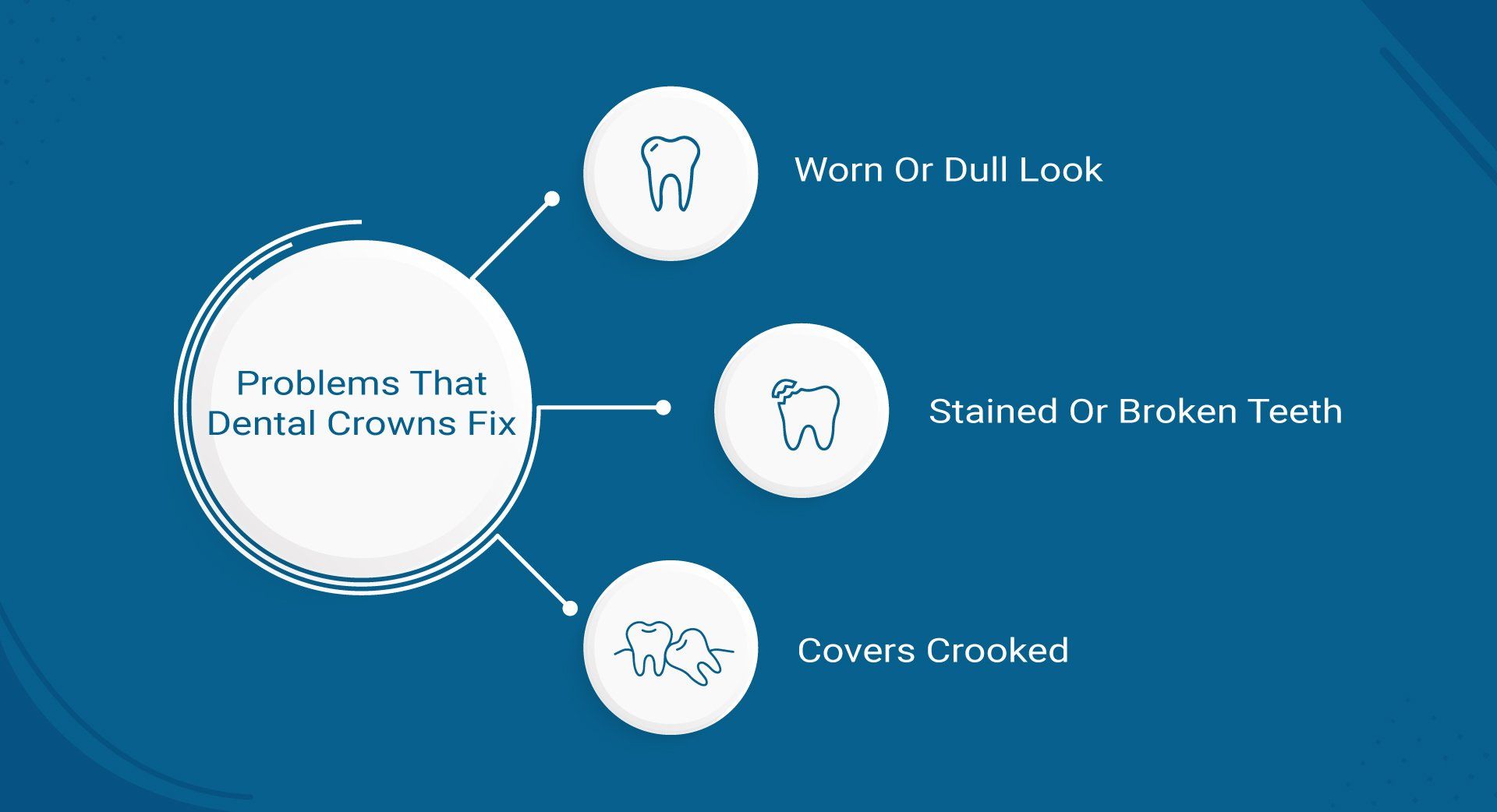 A diagram showing the problems that dental crowns fix.