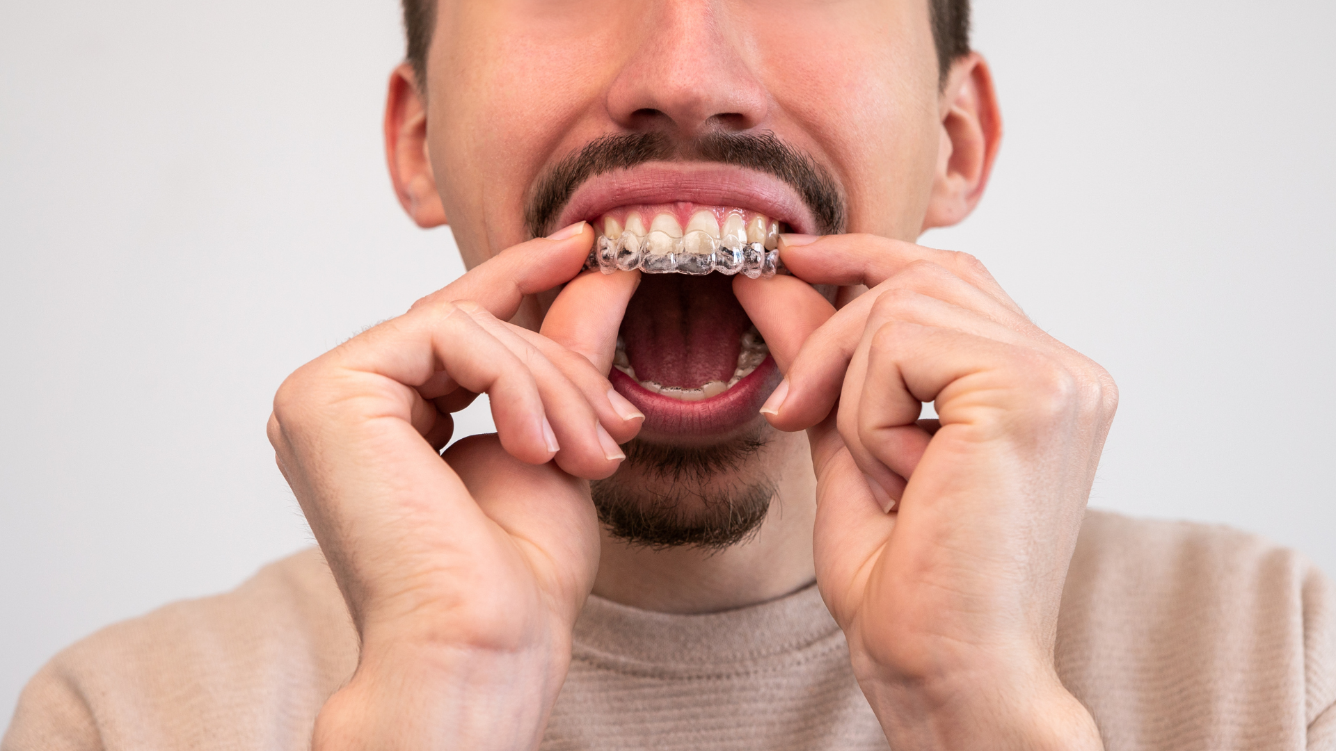 Dental model with white teeth, on blue and white platform, showing upper and lower dental arches.