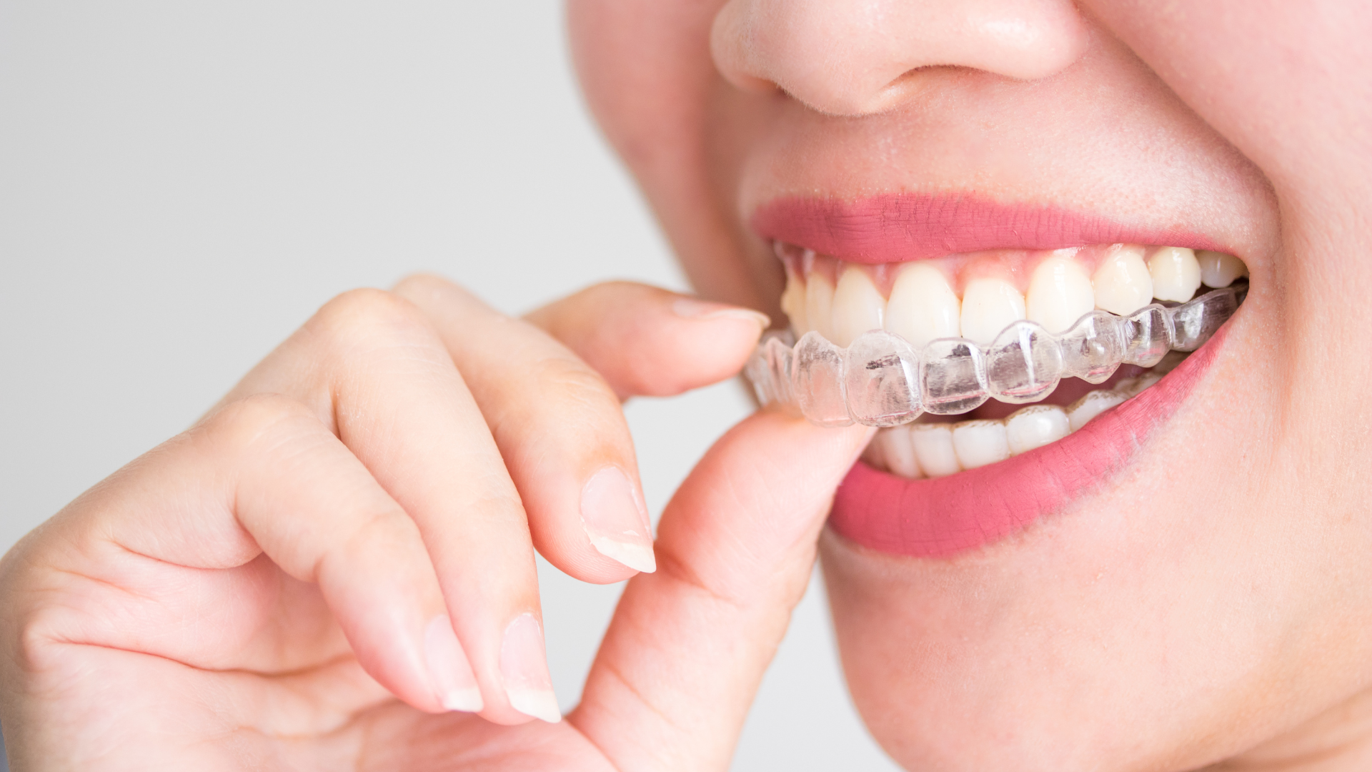 a dentist is holding a model of teeth and a pen .