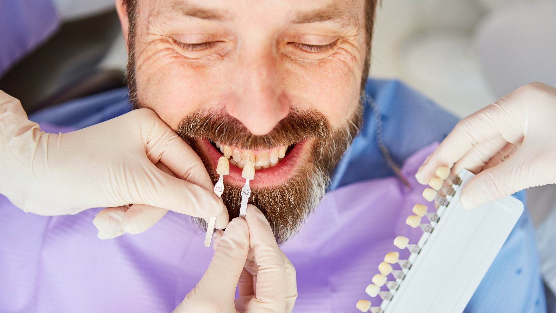 A dentist holding a shade guide next to a patient's teeth to match the color for a dental procedure.
