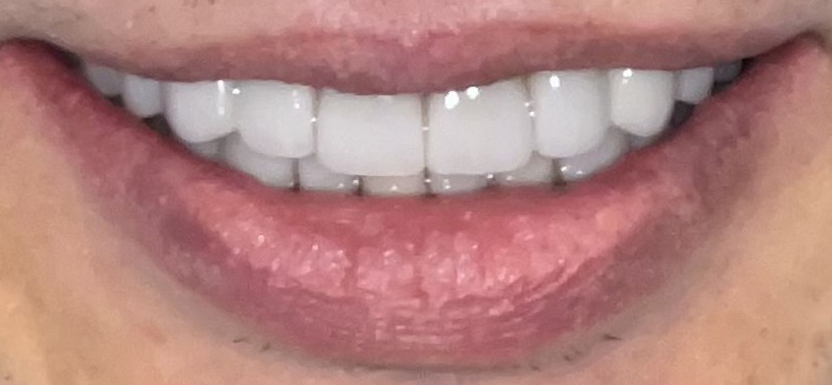 A close up of a person 's mouth with white teeth.