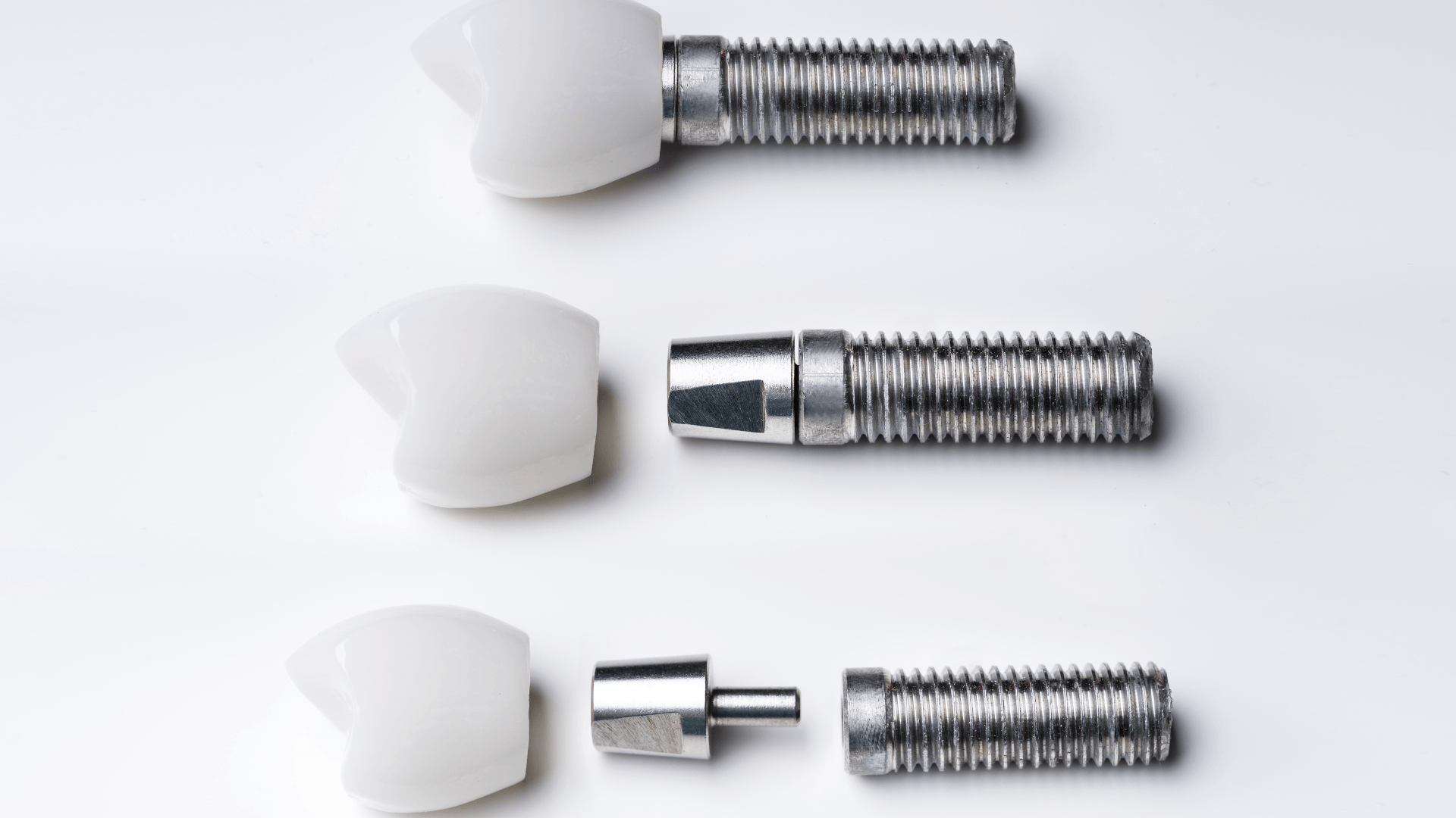 Dental Implant