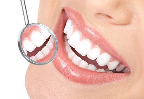 Healthy Teeth — White Teeth Close Up in Wilmington, NC 