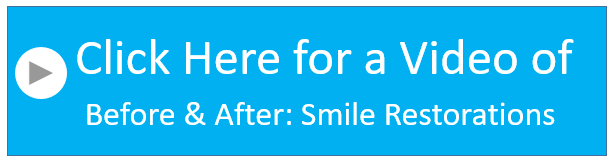 Before & After: Smile Restorations