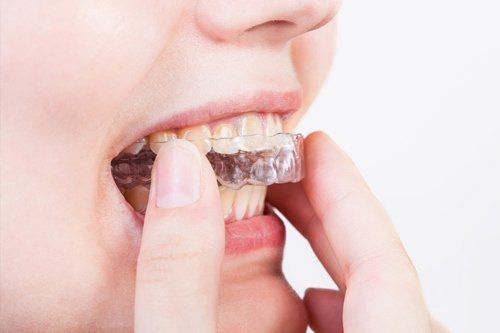 Bruxism — Woman Putting Orthodontic Brace in Wilmington, NC