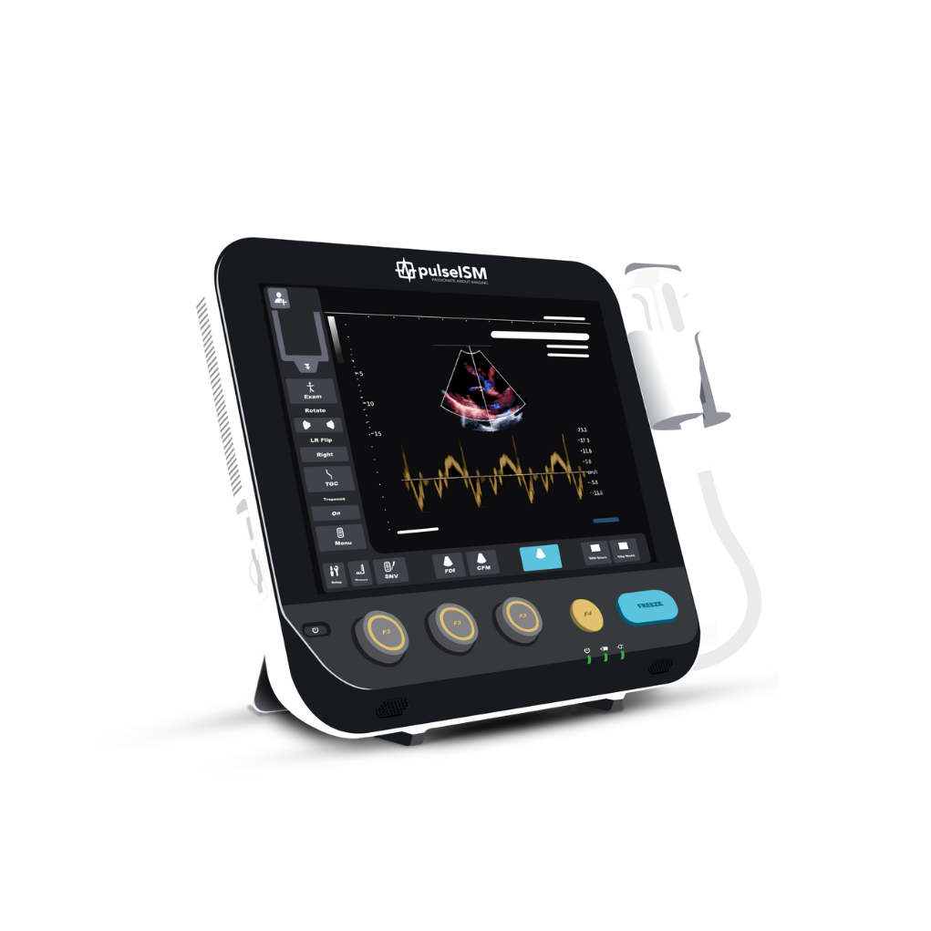 ultrasound systems