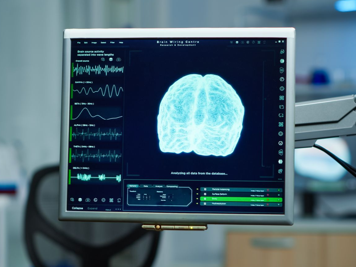 Monitor displaying a brain scan in a medical lab setting.