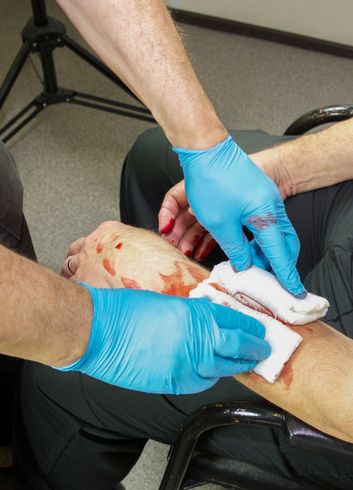 Hands in blue gloves cleaning blood from an injured arm and hand with white pads.