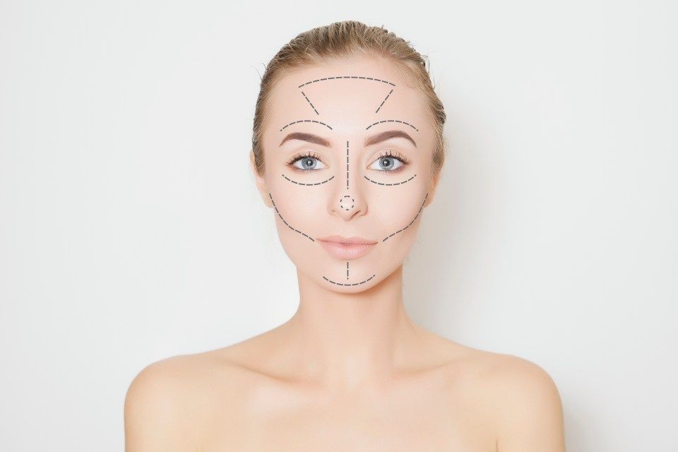 Reshaping facial lines