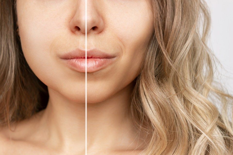 Chirurgia del viso prima e dopo