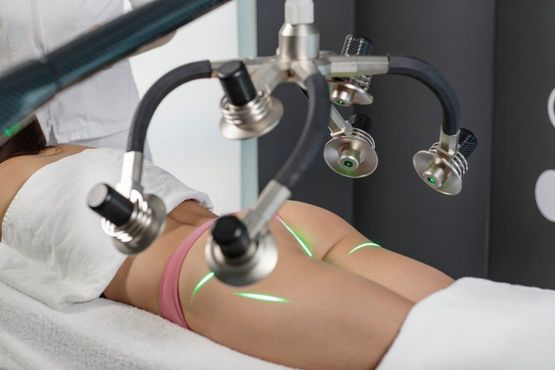 Liposuzione laser assistita su glutei