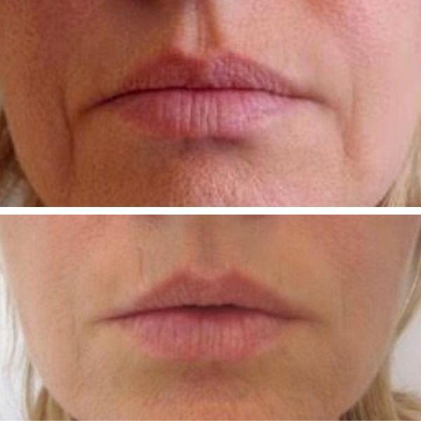 Cosmetic_Before-and-After