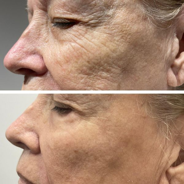 Cosmetic_Before-and-After