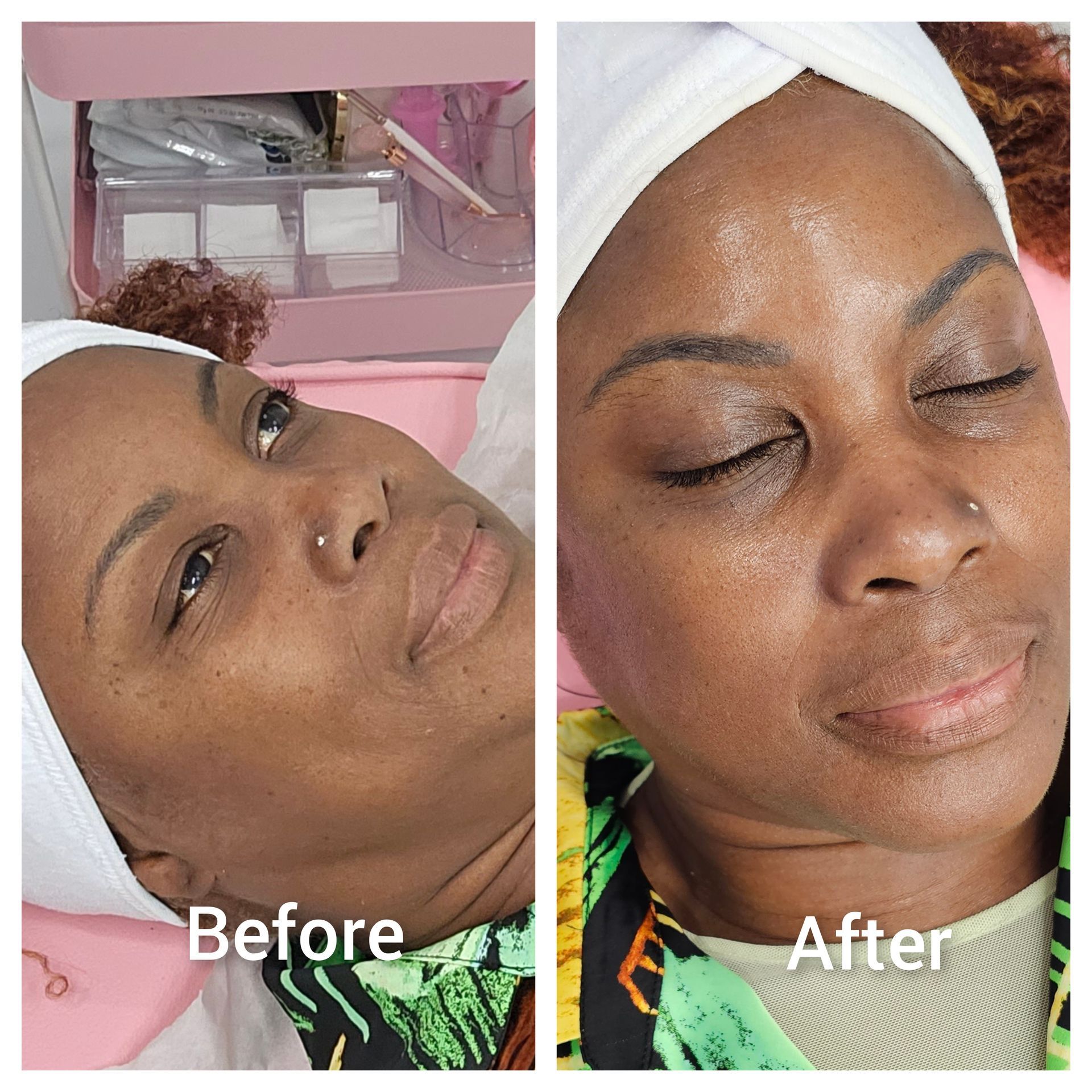 A before and after photo of a woman 's face.