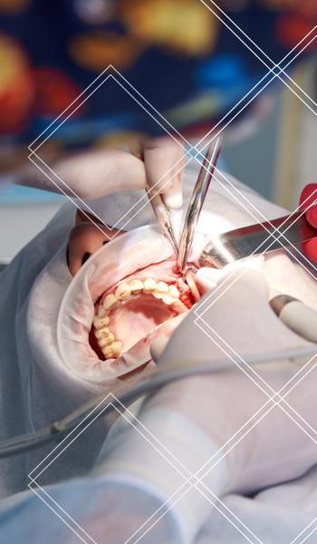 A dentist is working on a patient 's teeth in an operating room.