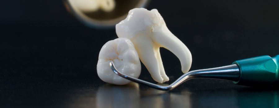 A close up of a tooth and a dental tool on a table.