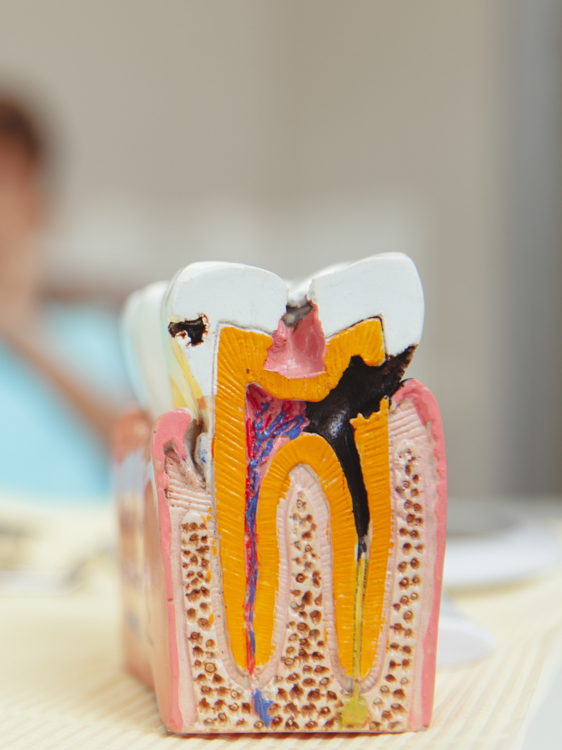 A woman is getting her teeth whitened at the diamond dental studio