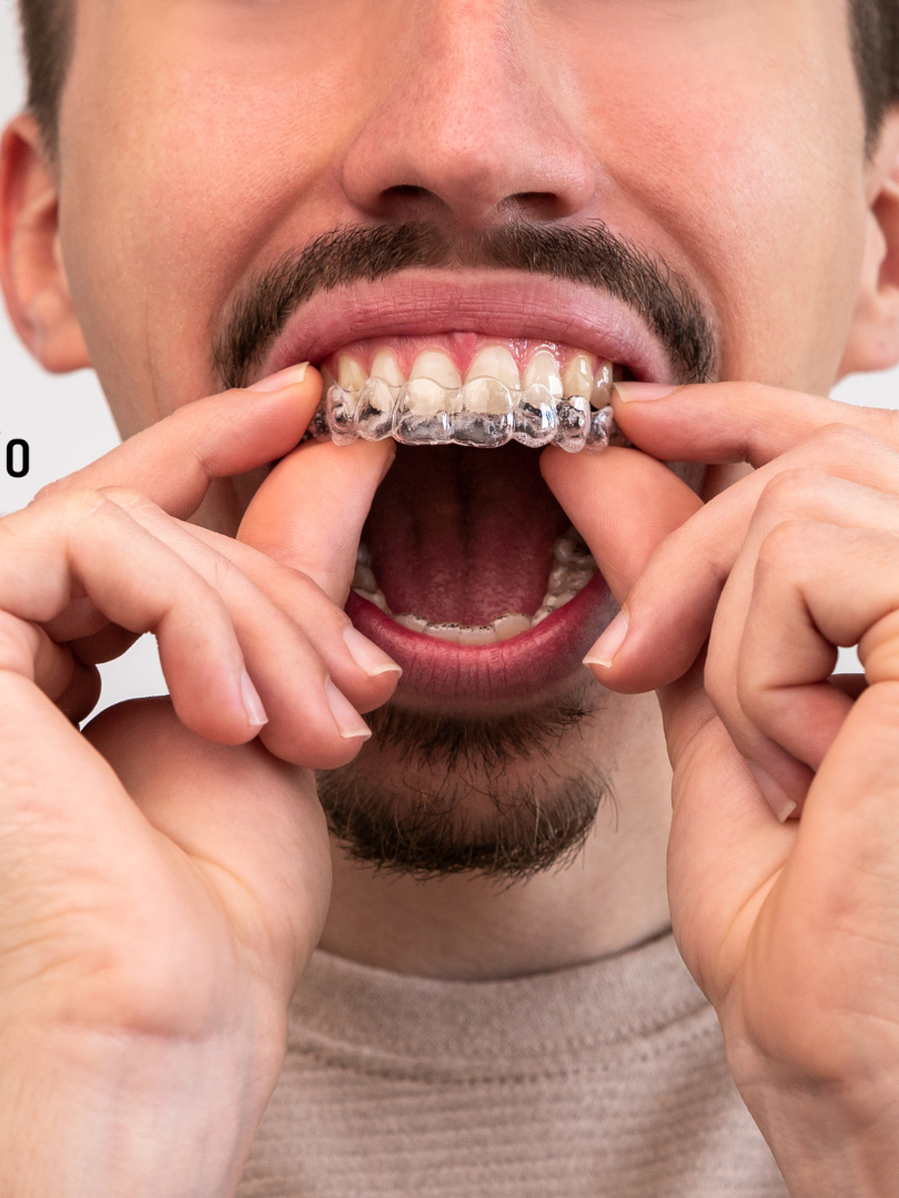 A woman is getting her teeth whitened at the diamond dental studio