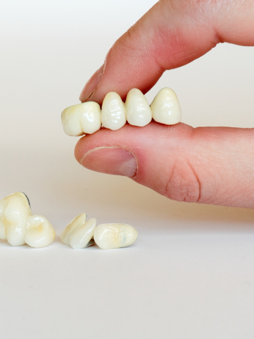 A woman is getting her teeth whitened at the diamond dental studio