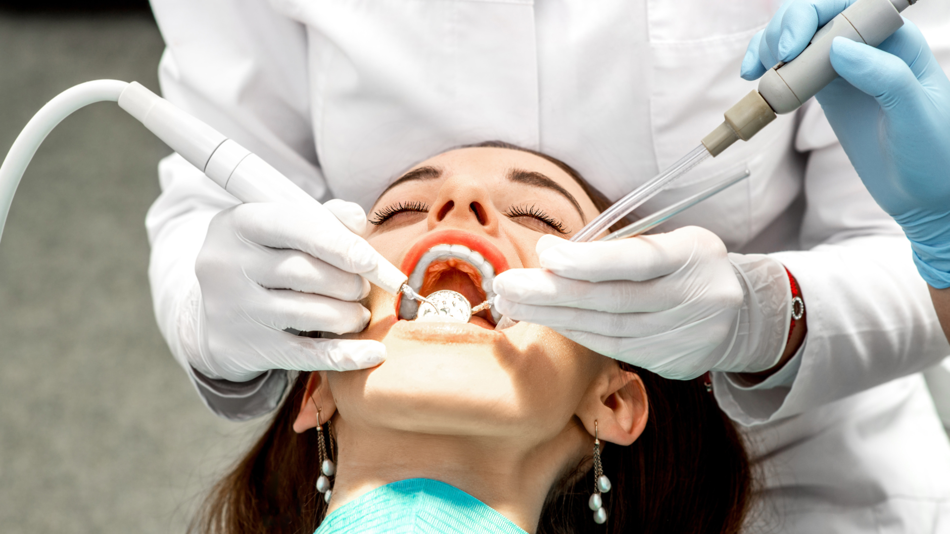 deep teeth cleaning