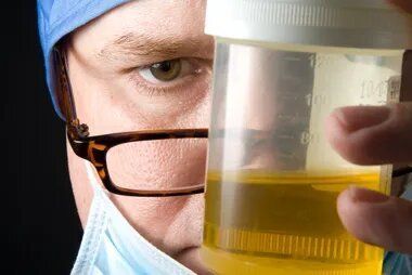 Urine Test — Dallas, TX — Effective Professionals