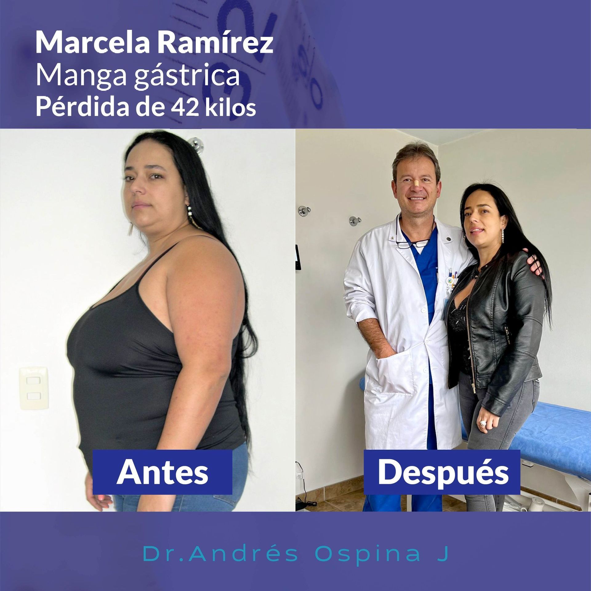 Una foto de antes y después de Marcela Ramírez.