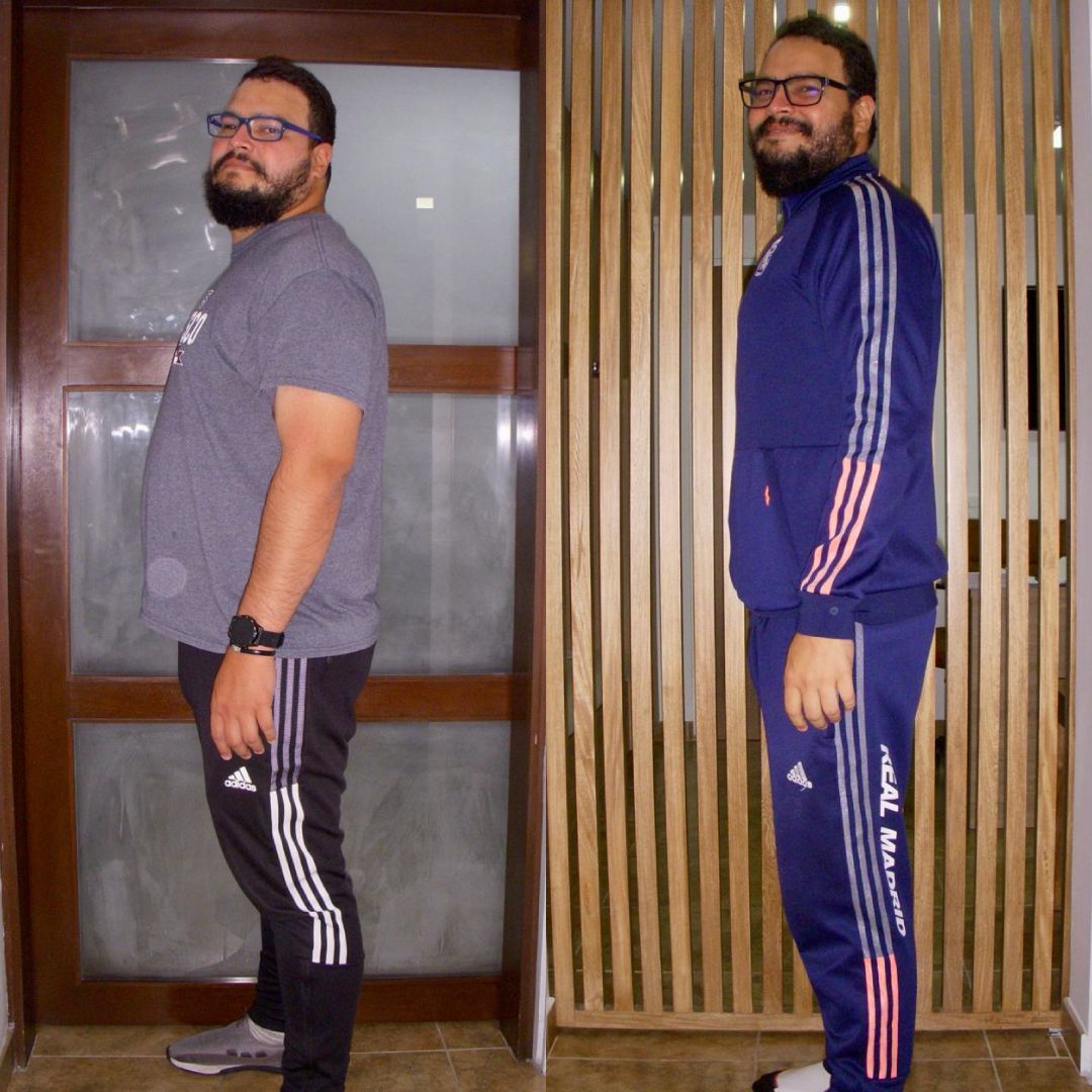Hombre con gafas, antes y después de perder peso. Izquierda: camisa gris, pantalón negro.