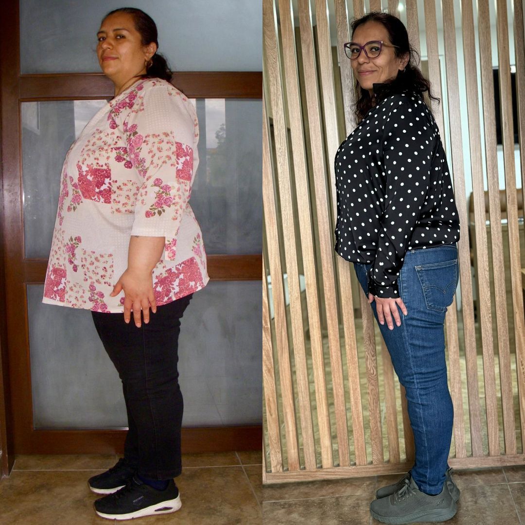 Una mujer antes y después de perder peso está de pie junto a una valla de madera.