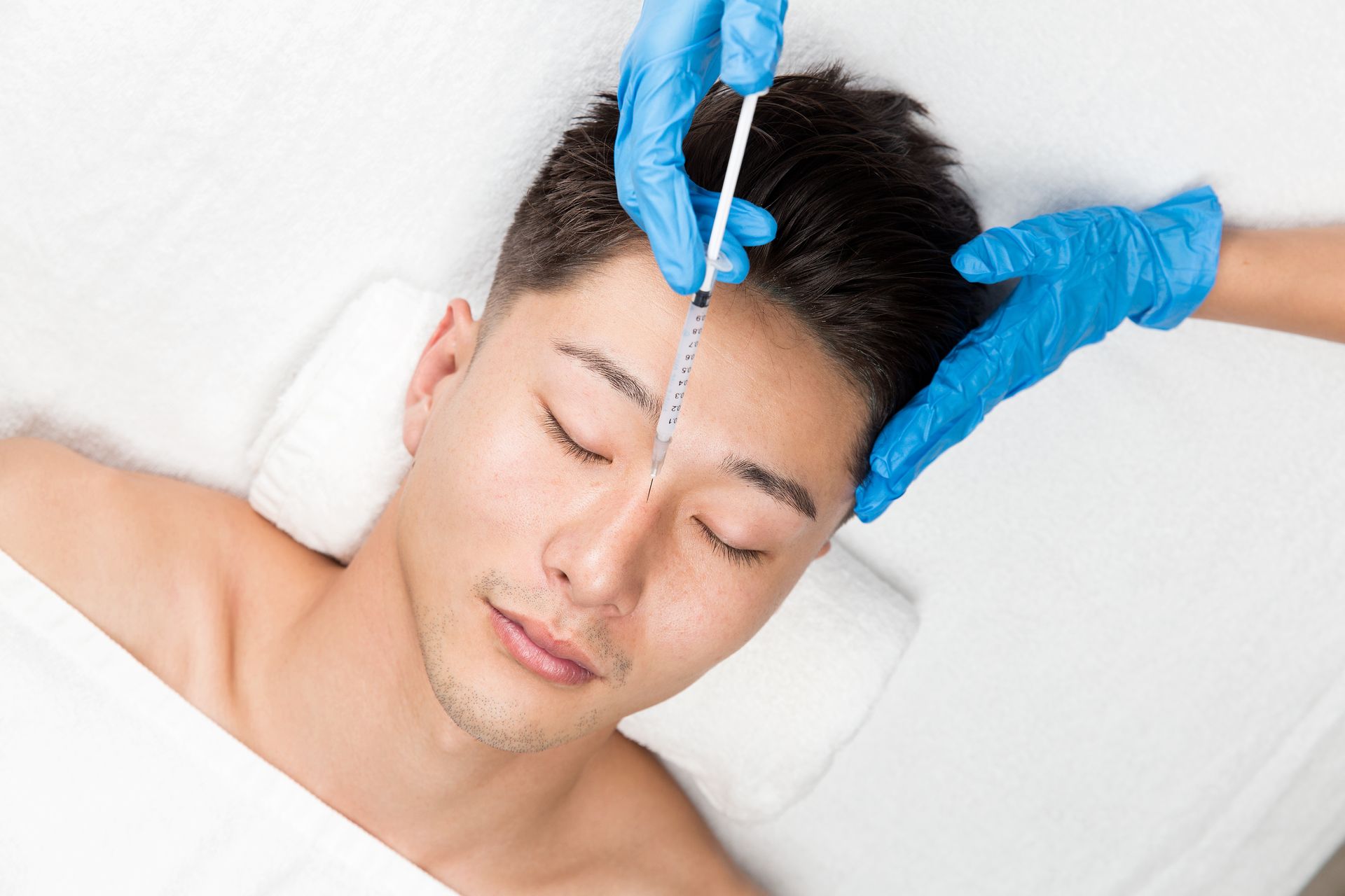 Ein Mann bekommt eine Botox-Injektion in die Stirn.