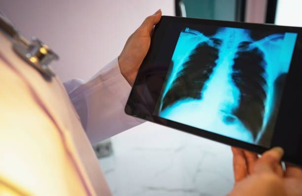 A Doctor Is Looking At An X-Ray On A Tablet — Chicago, IL — Chicagoland Home Physicians