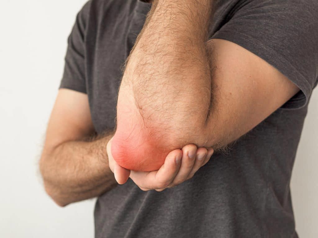 Elbow bursitis pain and inflammation treated with physiotherapy at Dynamic Physiotherapy Mississauga