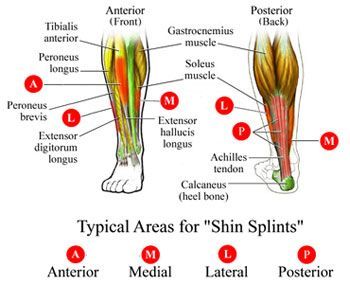 Shin Splints Treatment Mississauga