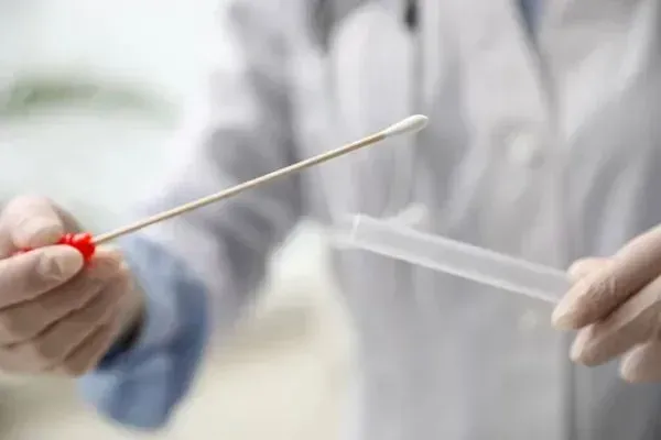 A doctor is holding a swab and a test tube.
