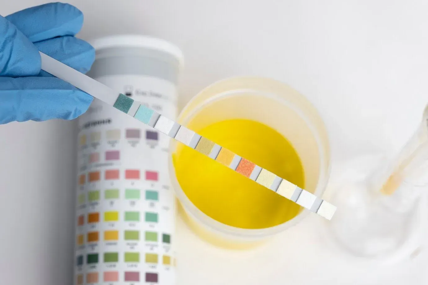 A person is holding a test strip over a cup of urine.