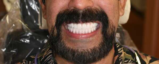 After