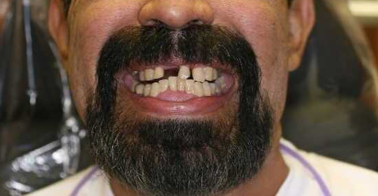 Before
