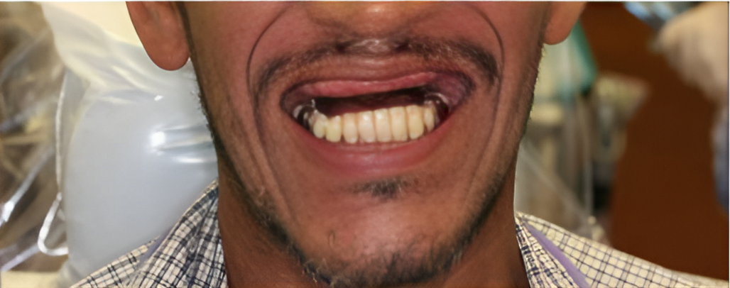Before