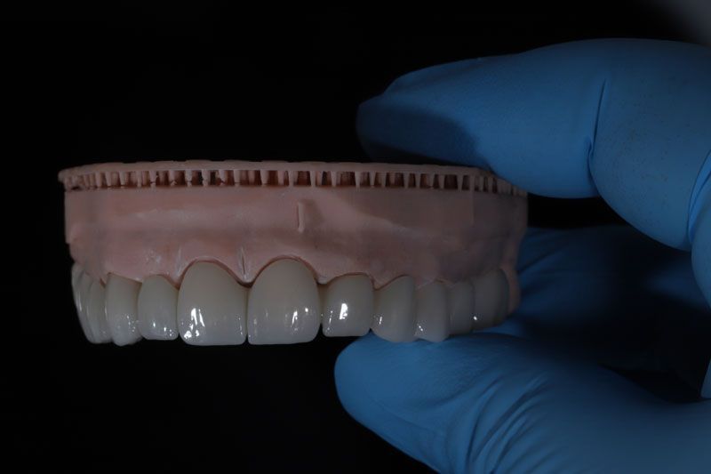 a full arch of teeth with holes