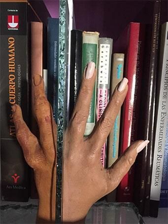 DR. FREDY ESQUINCA VILLATORO - VALORACIÓN PRECAUTORIA