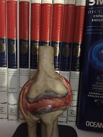 DR. FREDY ESQUINCA VILLATORO - DENSITOMETRÍA ÓSEA