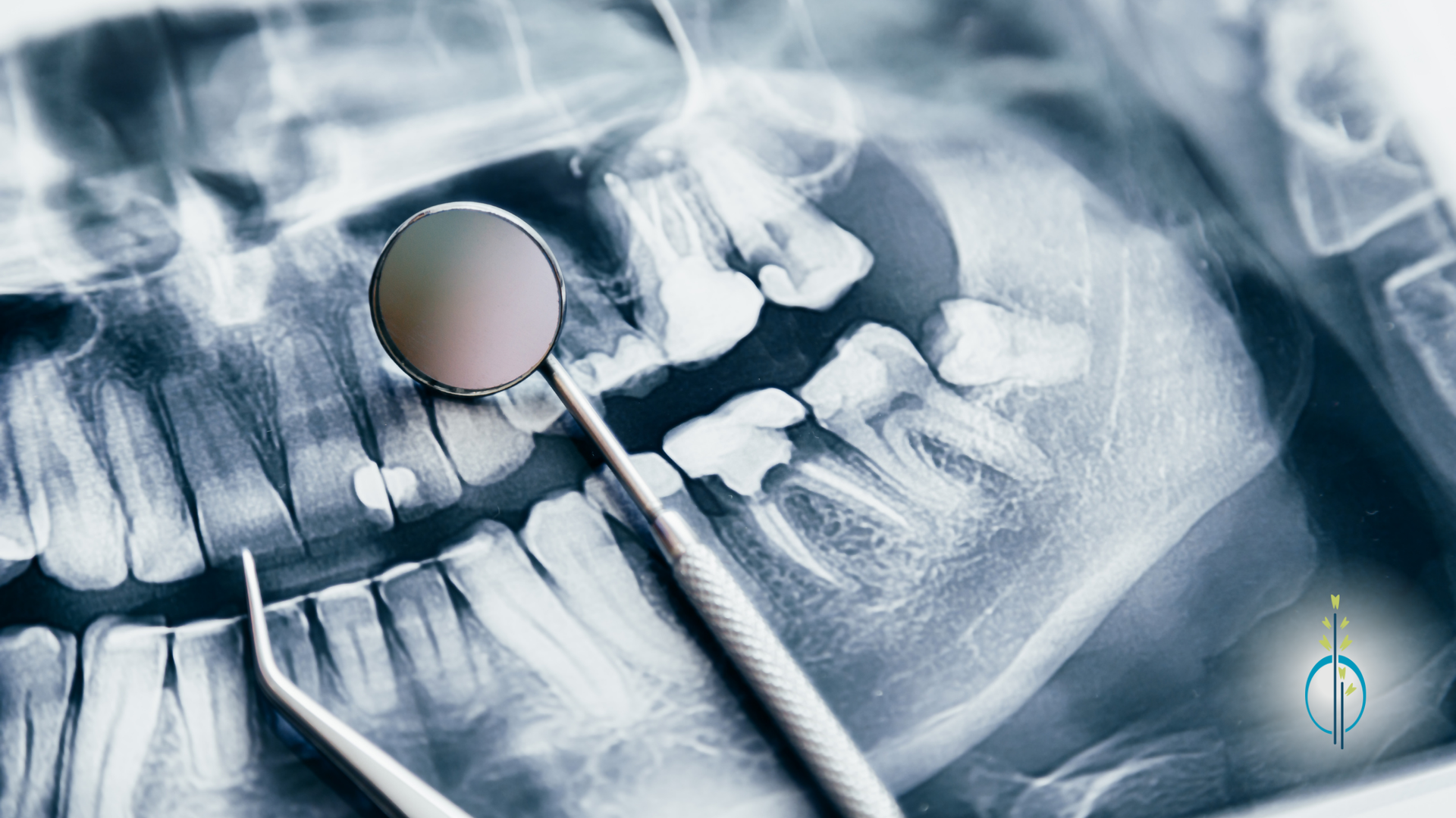 An x-ray of a person 's teeth with a dental mirror and tweezers.