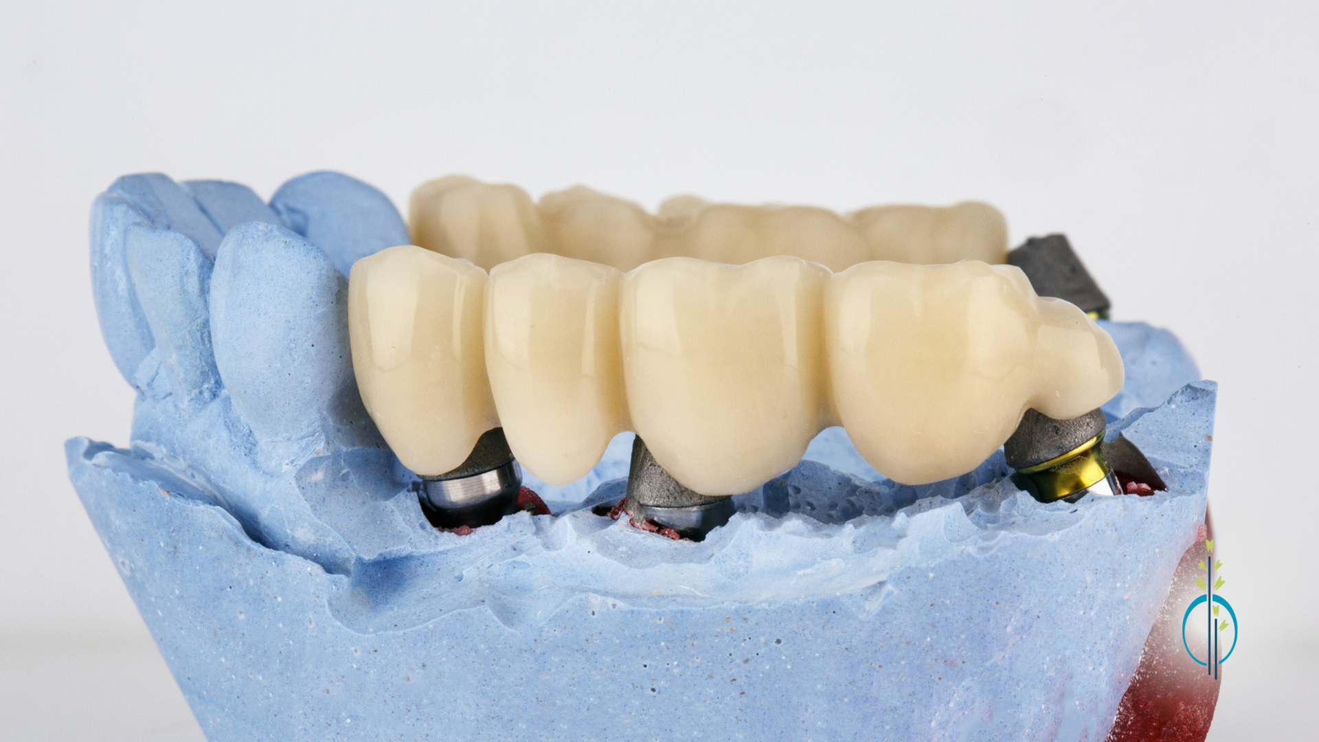 A close up of a model of a person 's teeth on a blue surface.