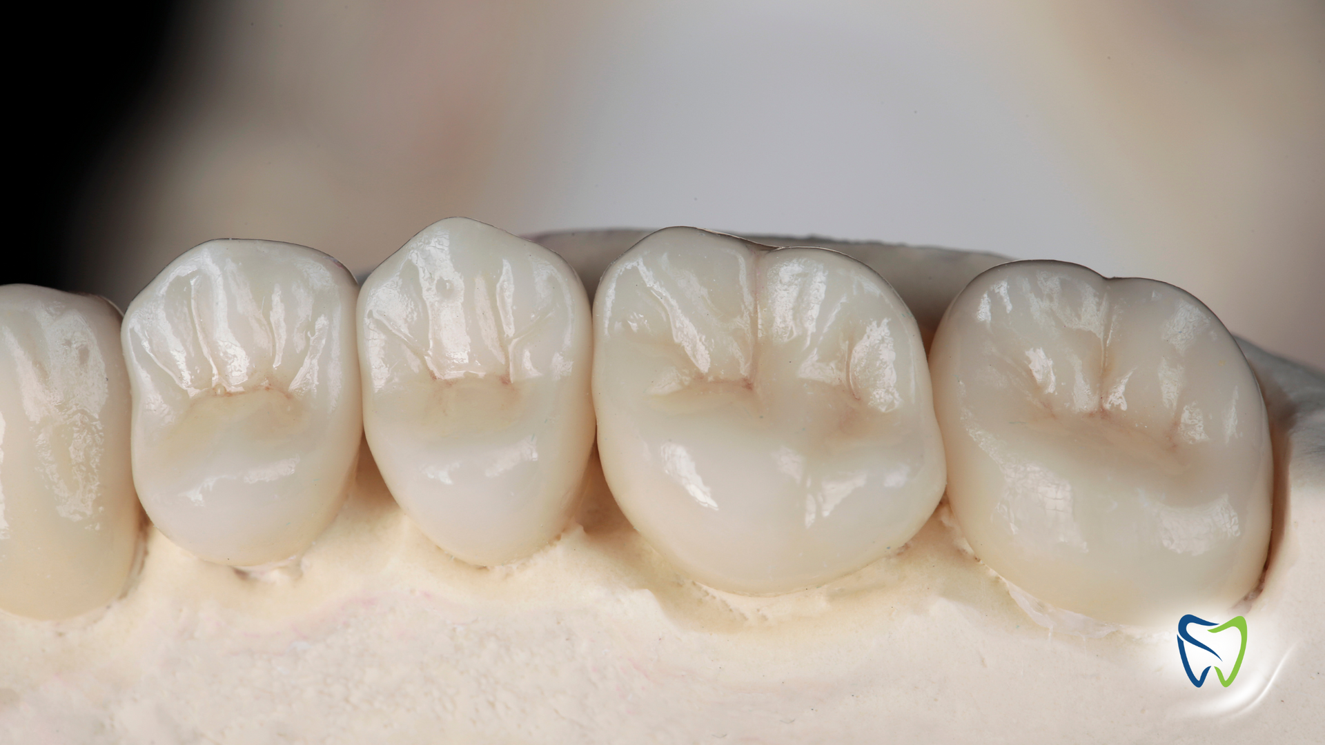 A close up of a model of a person 's teeth.